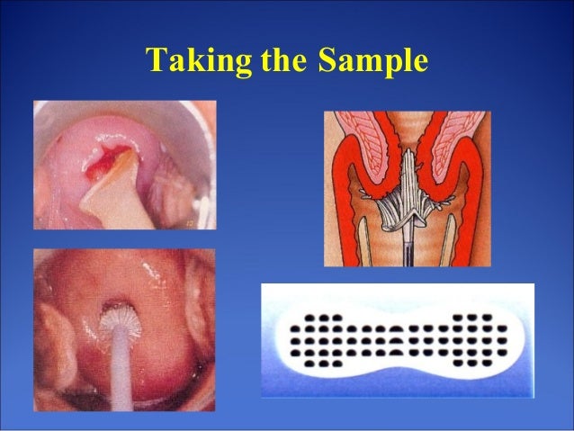 Cytopathology: An Introduction